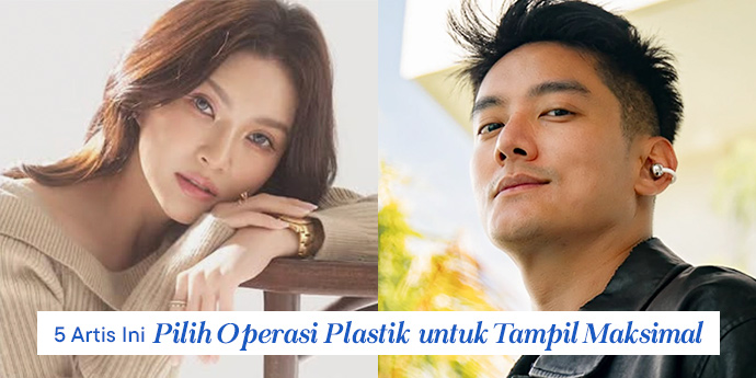 5 Artis Ini Pilih Jalur Operasi Plastik untuk Tampil Maksimal!