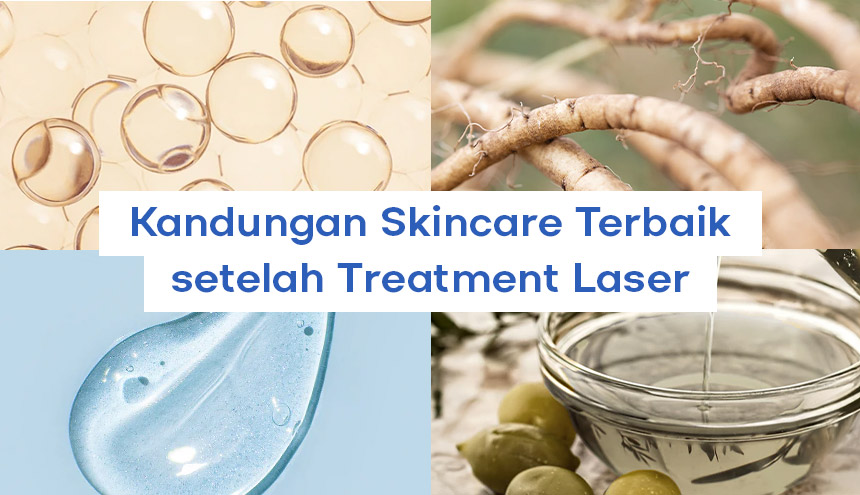 4 Kandungan Skincare Terbaik Digunakan setelah Treatment Laser, Jangan Sampai Salah!