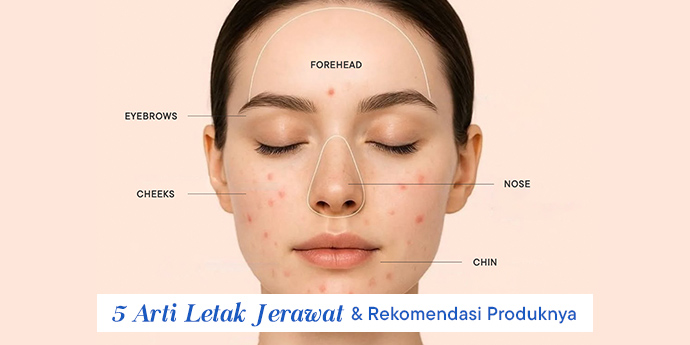 5 Arti Letak Jerawat & Rekomendasi Produk untuk Mengatasinya