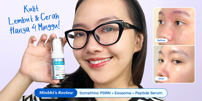 Review Somethinc PDRN Serum: PDRN Vegan, Kulit  Lembut dan Cerah Hanya 4 Minggu!